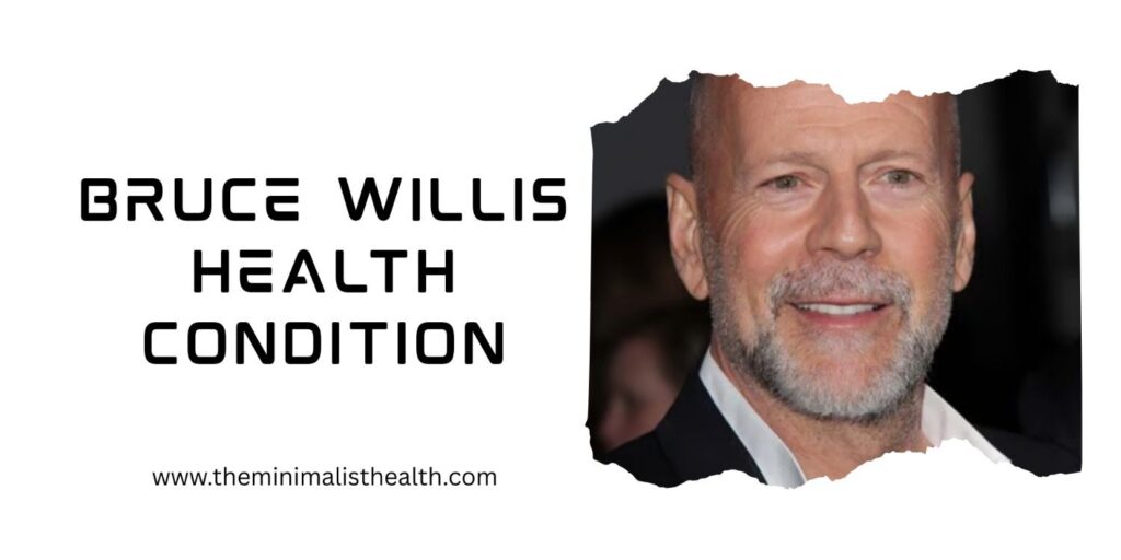What is the health condition of Bruce Willis? 2 Bruce Willis Health Condition